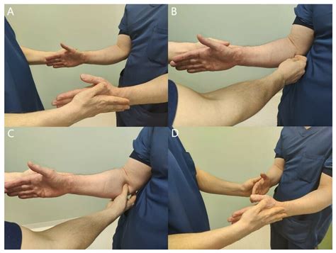 scratch test for nerve compression